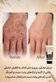 کرم مرطوب کننده دست و صورت